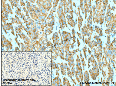 Anti-Midkine Rabbit mAb [77M20M27]