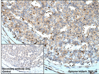 Anti-D4 GDI Rabbit mAb [65M94L61]