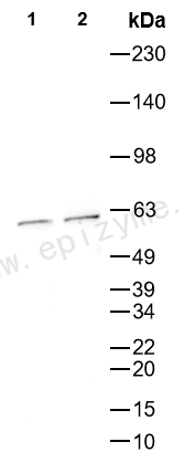 Anti-Tyrosine Hydroxylase Rabbit mAb [57K66L92]