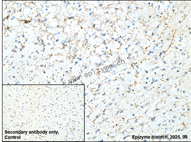 Anti-Tyrosine Hydroxylase Rabbit mAb [57K66L92]