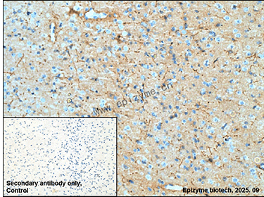Anti-Tyrosine Hydroxylase Rabbit mAb [57K66L92]