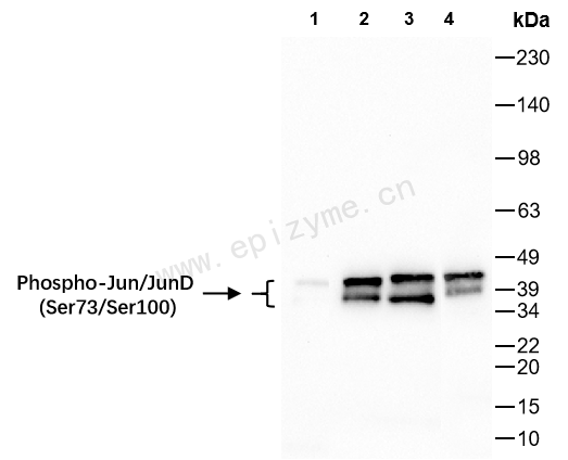Anti-Phospho-Jun/JunD (Ser73/Ser100) Rabbit mAb [40K64M01]