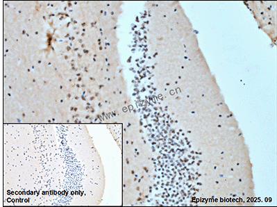 Anti-Phospho-Jun/JunD (Ser73/Ser100) Rabbit mAb [40K64M01]