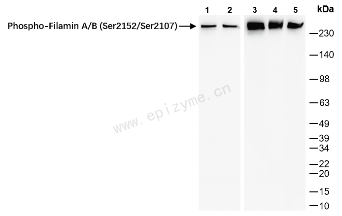 Anti-Phospho-Filamin A/B (Ser2152/Ser2107) Rabbit mAb [20K07K34]