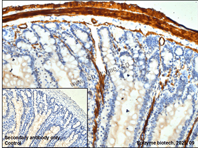 Anti-Phospho-Filamin A/B (Ser2152/Ser2107) Rabbit mAb [20K07K34]