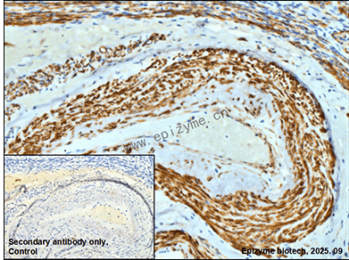 Anti-Phospho-Filamin A/B (Ser2152/Ser2107) Rabbit mAb [20K07K34]