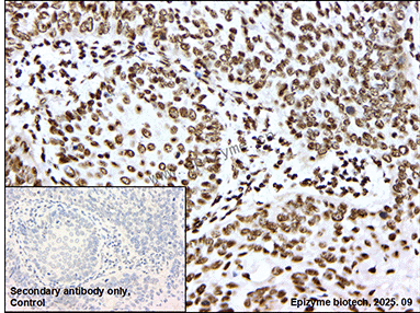 Anti-Phospho-Rb2 p130 (Ser952) Rabbit mAb [17K27K86]