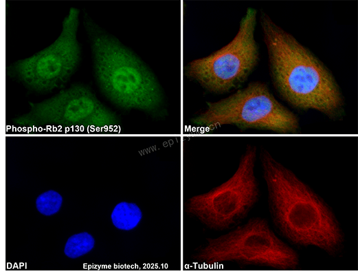 Anti-Phospho-Rb2 p130 (Ser952) Rabbit mAb [17K27K86]