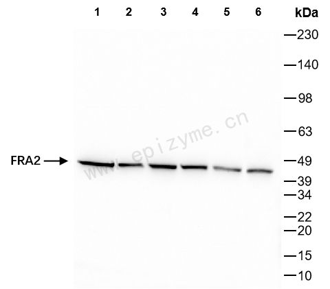 Anti-FRA2 Rabbit mAb [98K64M18]