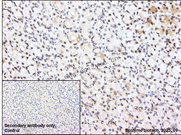 Anti-Phospho-Rb (Thr252) Rabbit mAb [45K05L75]