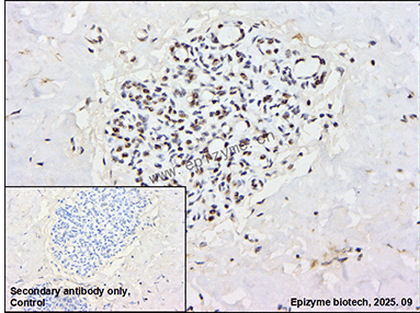 Anti-Phospho-Rb (Thr252) Rabbit mAb [45K05L75]
