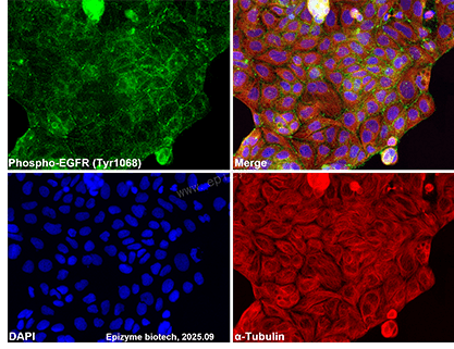 Anti-Phospho-EGFR (Tyr1068) Rabbit mAb [55L95L14]