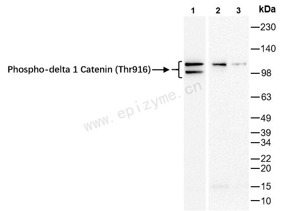 Anti-Phospho-delta 1 Catenin (Thr916) Rabbit mAb [12K71L79]