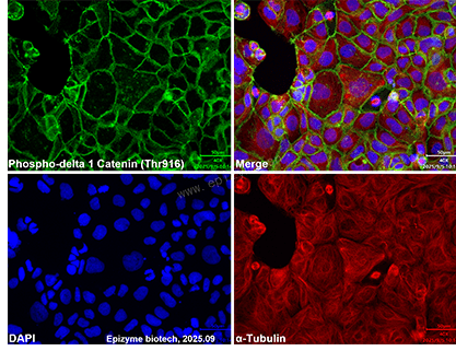 Anti-Phospho-delta 1 Catenin (Thr916) Rabbit mAb [12K71L79]