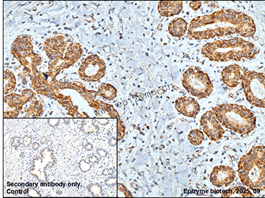 Anti-Phospho-delta 1 Catenin (Thr916) Rabbit mAb [12K71L79]