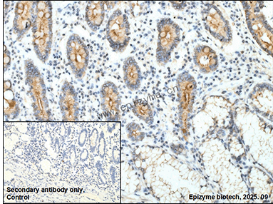 Anti-Phospho-delta 1 Catenin (Thr916) Rabbit mAb [12K71L79]