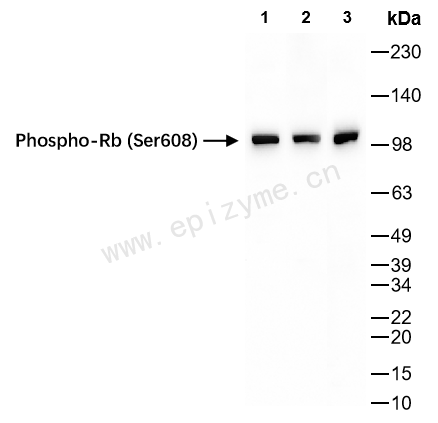 Anti-Phospho-Rb (Ser608) Rabbit mAb [89K02M77]