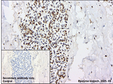 Anti-Phospho-Rb (Thr356) Rabbit mAb [86K71M61]