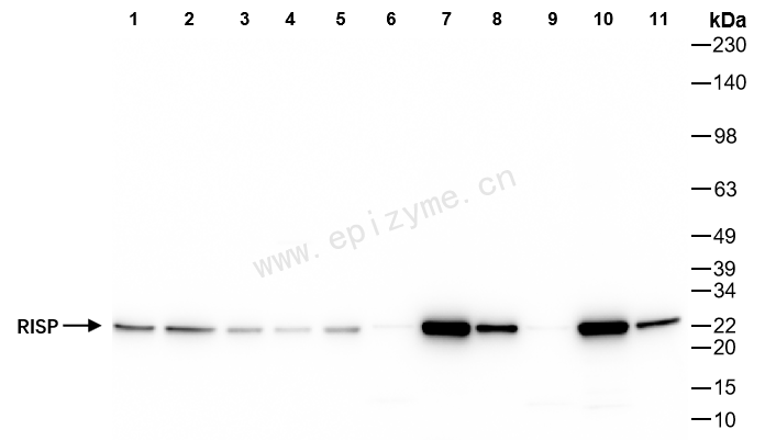 Anti-Complex III Subunit 5 Rabbit mAb [10K48K15]