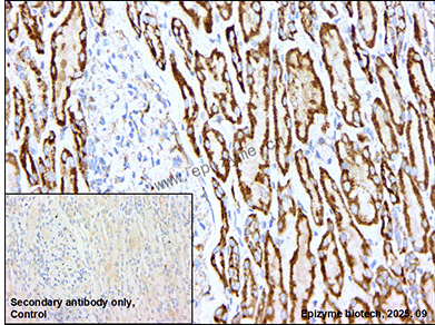 Anti-Complex III Subunit 5 Rabbit mAb [10K48K15]