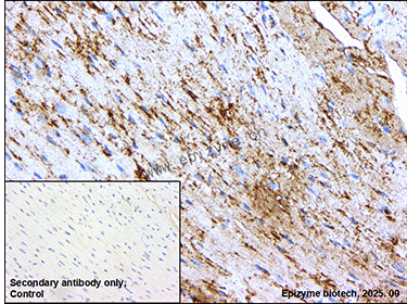 Anti-Complex III Subunit 5 Rabbit mAb [10K48K15]