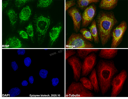 Anti-Complex III Subunit 5 Rabbit mAb [10K48K15]