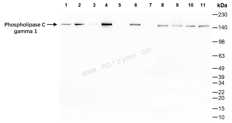 Anti-PLCG1 Rabbit mAb [13L80K83]