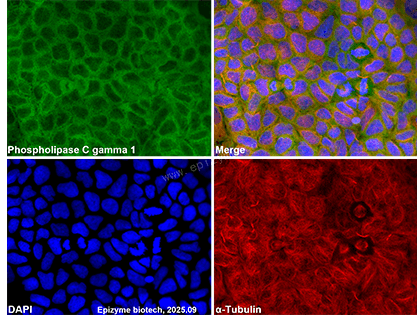 Anti-PLCG1 Rabbit mAb [13L80K83]