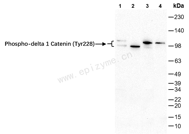 Anti-Phospho-delta 1 Catenin (Tyr228) Rabbit mAb [81M72K49]