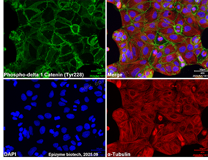 Anti-Phospho-delta 1 Catenin (Tyr228) Rabbit mAb [81M72K49]