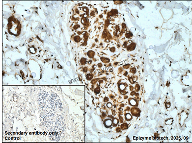 Anti-Phospho-delta 1 Catenin (Tyr228) Rabbit mAb [81M72K49]