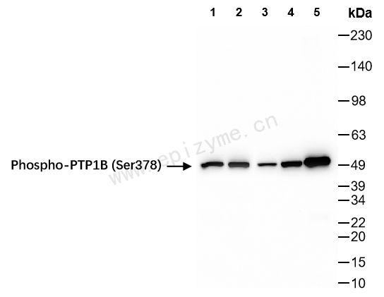 Anti-Phospho-PTP1B (Ser378) Rabbit mAb [81L13M61]