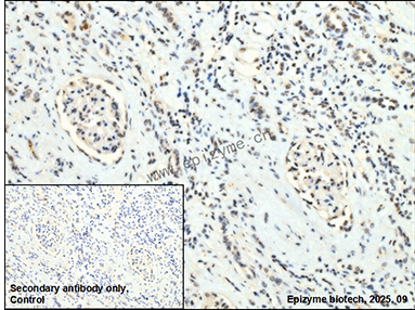 Anti-Phospho-PTP1B (Ser378) Rabbit mAb [81L13M61]