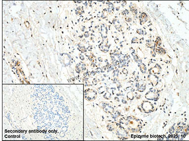 Anti-Phospho-PKC delta (Tyr311) Rabbit mAb [40P03Q48]