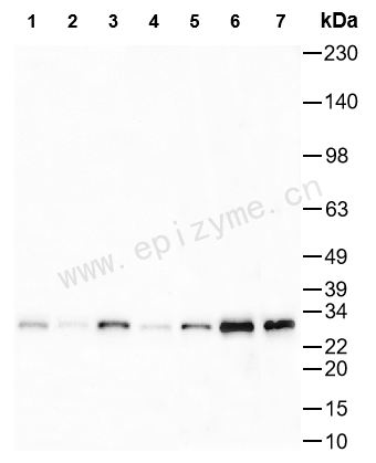 Anti-SIRT5 Rabbit mAb [64P88G10]