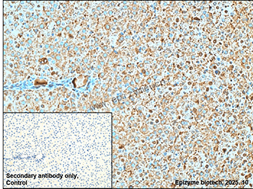 Anti-SIRT5 Rabbit mAb [64P88G10]
