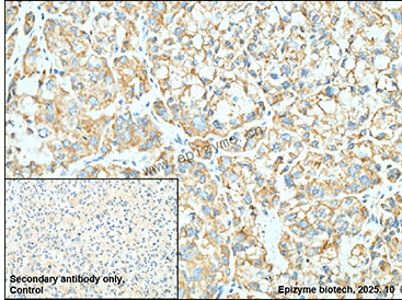 Anti-SIRT5 Rabbit mAb [64P88G10]