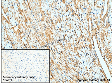 Anti-SIRT5 Rabbit mAb [64P88G10]