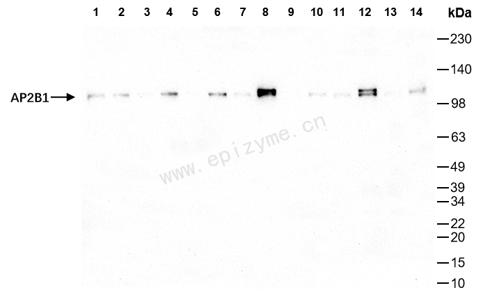 Anti-AP2B1 Rabbit mAb [61L45M14]