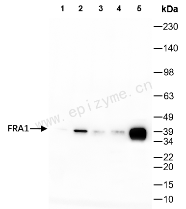 Anti-FOSL1 Rabbit mAb [32A72M92]
