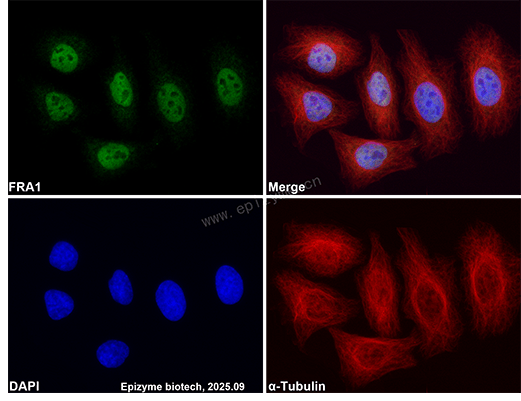 Anti-FOSL1 Rabbit mAb [32A72M92]