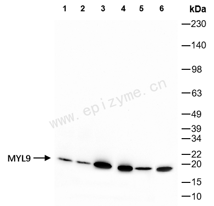 Anti-MYL9 Rabbit mAb [60N49Q31]