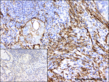 Anti-MYL9 Rabbit mAb [60N49Q31]