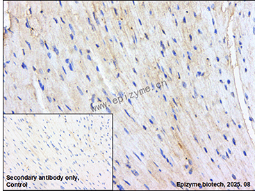 Anti-MYL9 Rabbit mAb [60N49Q31]