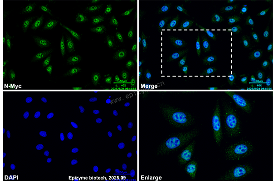 Anti-N-Myc/MYCN Rabbit mAb [19E67J65]