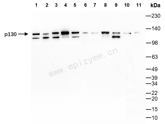 Anti-Rb2/p130 Rabbit mAb [82T23L10]