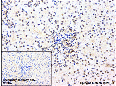 Anti-Rb2/p130 Rabbit mAb [82T23L10]