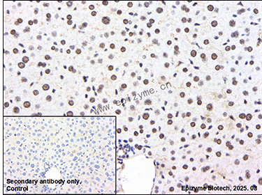 Anti-Rb2/p130 Rabbit mAb [82T23L10]