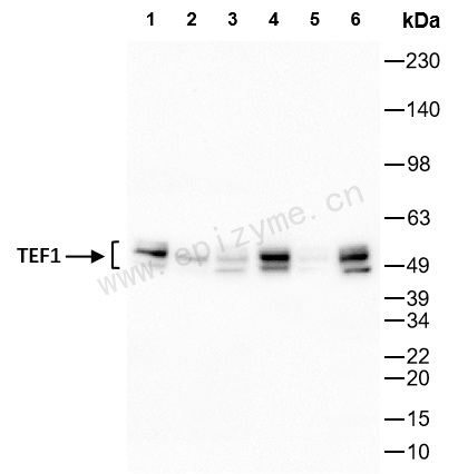 Anti-TEF1/TEAD-1 Rabbit mAb [53G63T17]