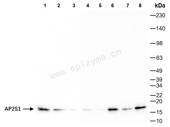 Anti-AP2S1 Rabbit mAb [29E15M06]